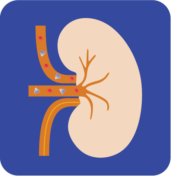 Healthy kidney
