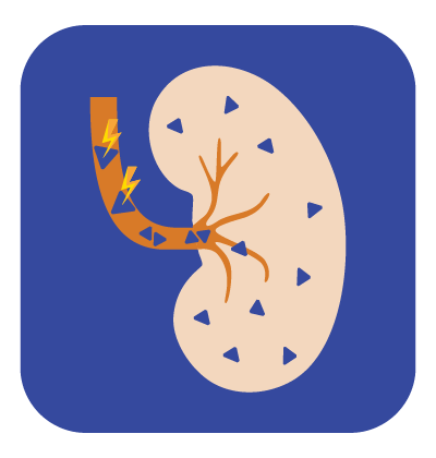 kidney Buildup